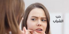 علاج حب الشباب الذي يظهر تحت الجلد