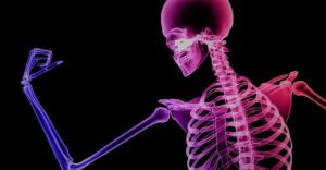 بحث عن مرض هشاشة العظام